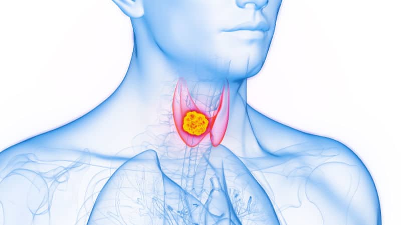 Thyroid Gland Scan Ascot