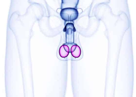 Testicular Scan Slough