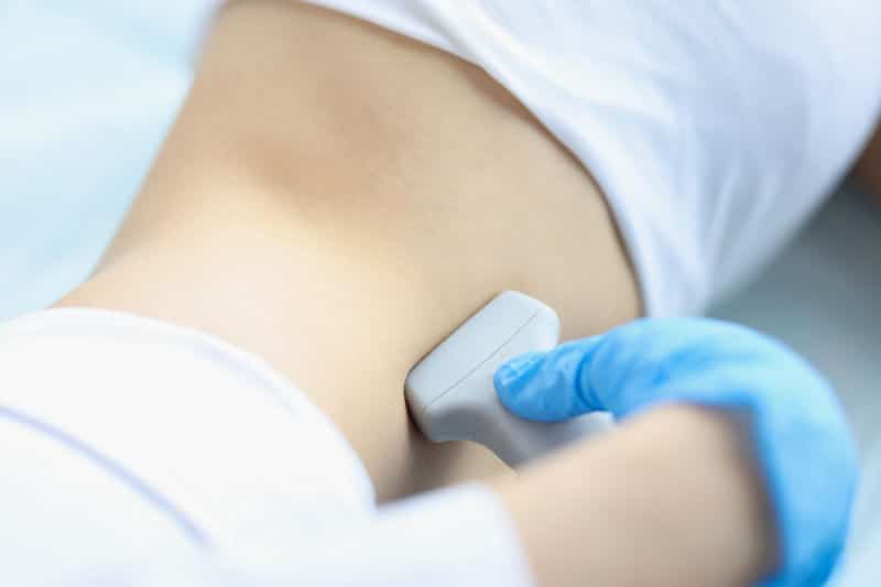 Abdominal Aortic Aneurysm AAA Screening